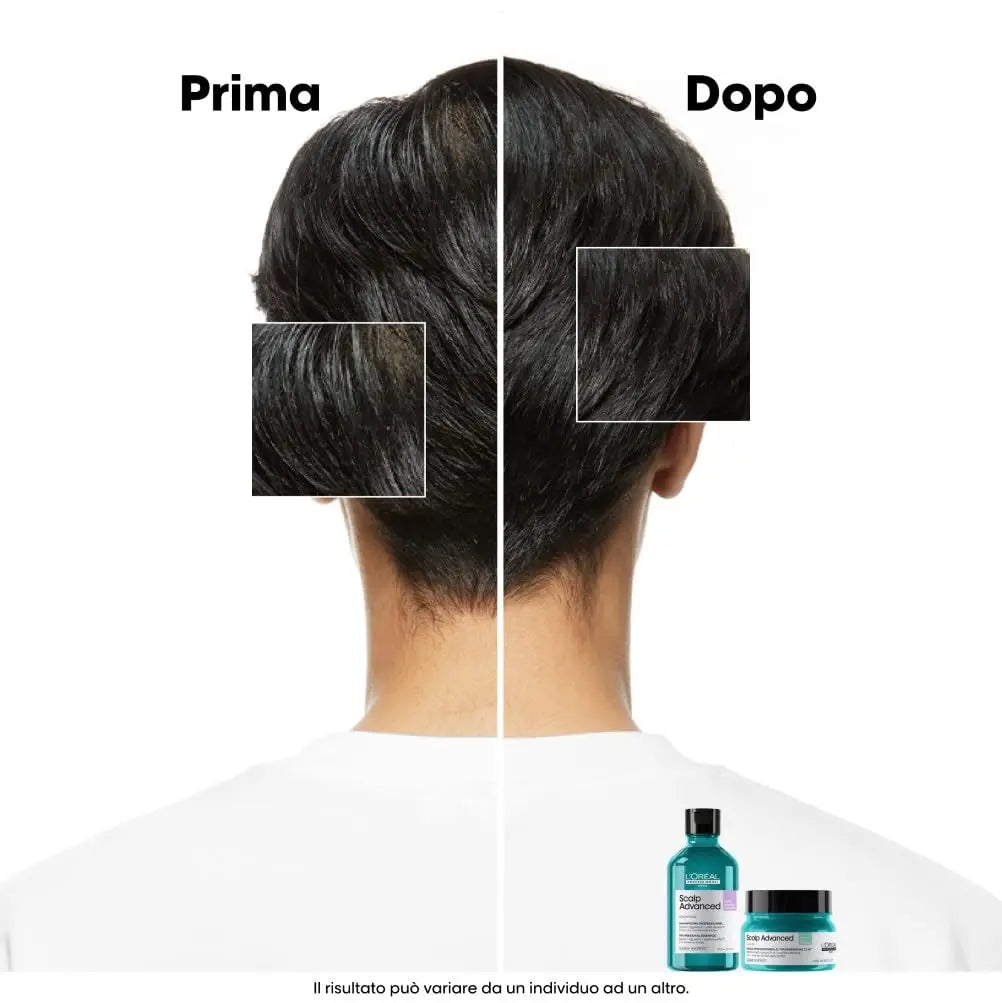 L'Oréal Professionnel Paris Shampoo Lenitivo, Per Cuoio Capelluto Grasso, Contro il Sebo in Eccesso, Effetto Rinfrescante, Con 4% AHA, Anti-Oiliness, Scalp Advanced, 1500 ml