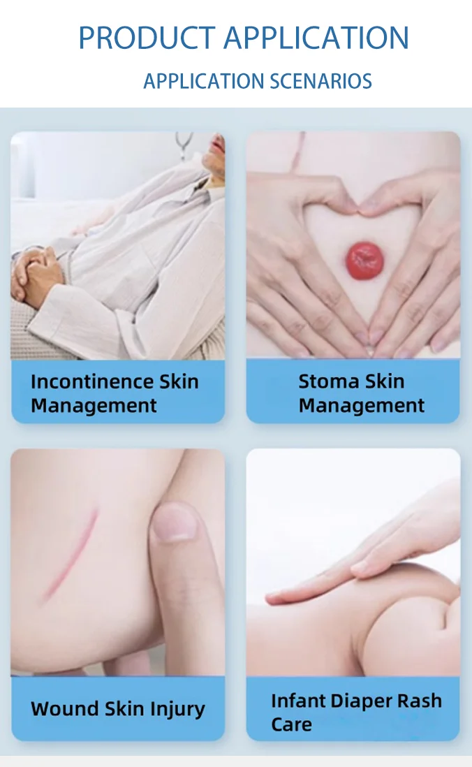 3M Cavilon 3346E 28ML Spray Barriera Cutanea Senza Alcool, Non Irritante, per la Cura del Nastro per Medicazioni Ostomiche