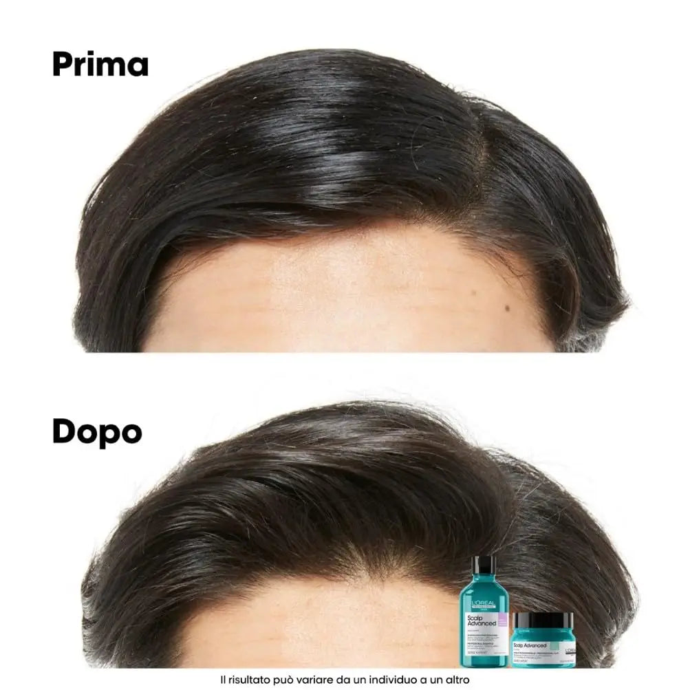 L'Oréal Professionnel Paris Shampoo Lenitivo, Per Cuoio Capelluto Grasso, Contro il Sebo in Eccesso, Effetto Rinfrescante, Con 4% AHA, Anti-Oiliness, Scalp Advanced, 1500 ml