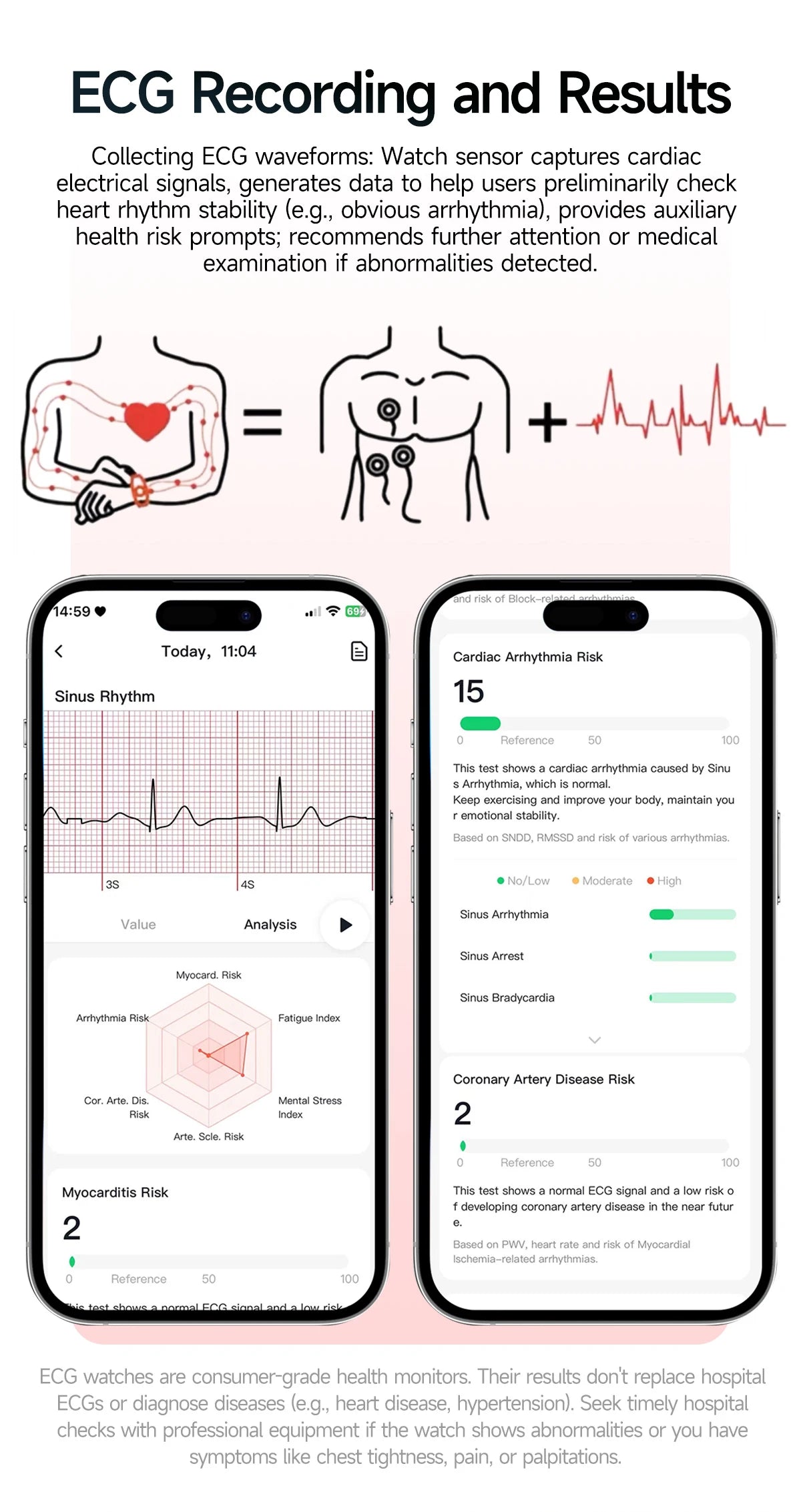 Nuovo Smartwatch per Uomo con Diagnosi ECG Accurata, Misurazione di Pressione Sanguigna, Ossigeno nel Sangue, Grasso nel Sangue, Acido Urico, Temperatura, Chiamate Bluetooth