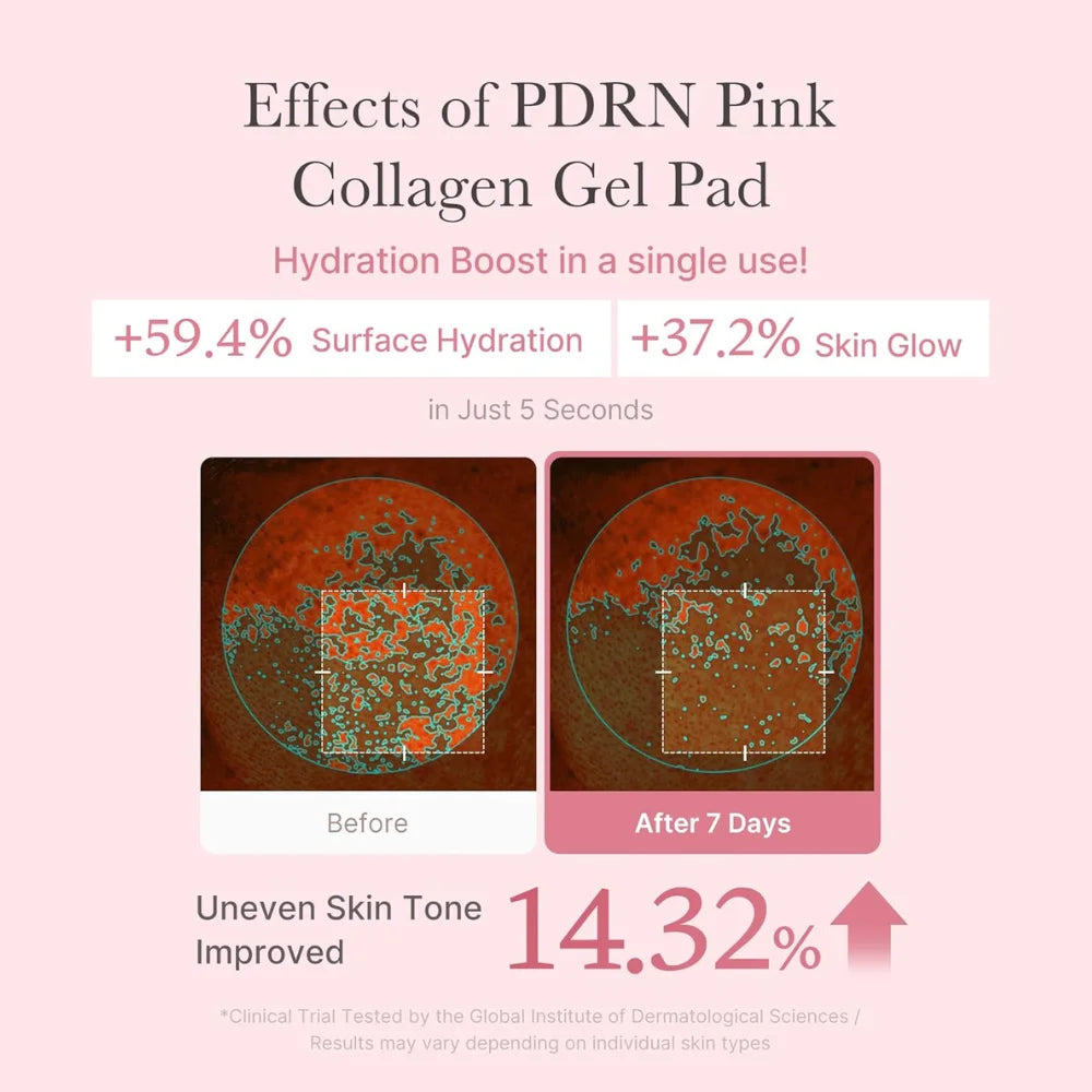 Medicube - PDRN Pink Collagen Toning Gel Pad con niacinamide e centella per idratare la pelle 70 unità