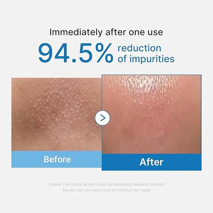 Medicube - Zero Foam Cleanser gel detergente dalla texture cremosa elimina le impurità senza seccare la pelle