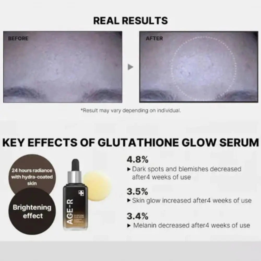 Medicube Glutathione Glow Serum 30 ml | Siero illuminante con glutatione e niacinamide per un tono più uniforme e una pelle con effetto “glow”