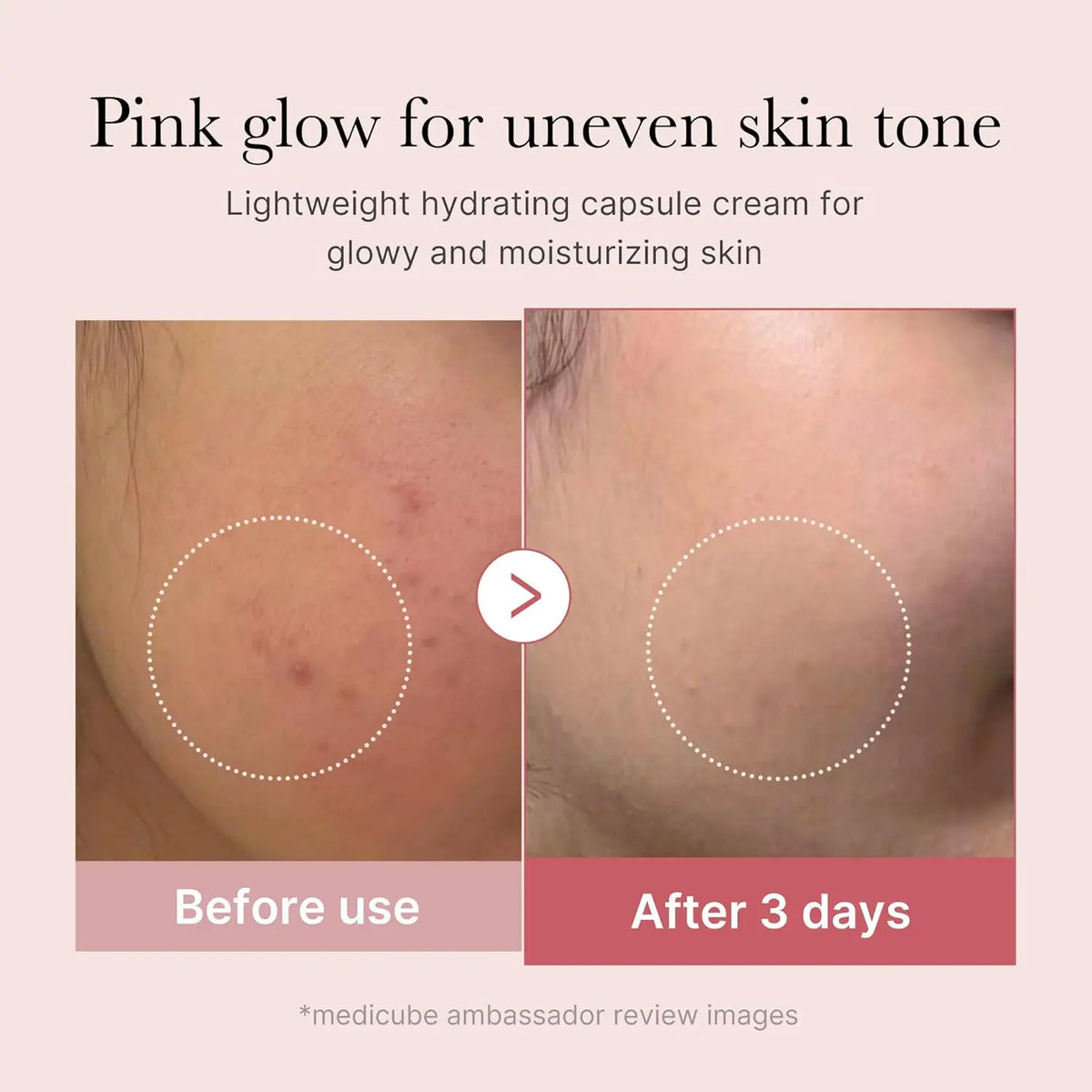 Medicube Salmon DNA PDRN Capsule Cream 55 g | Crema idratante leggera con PDRN e niacinamide per uniformare il tono della pelle e offrire un’idratazione luminosa