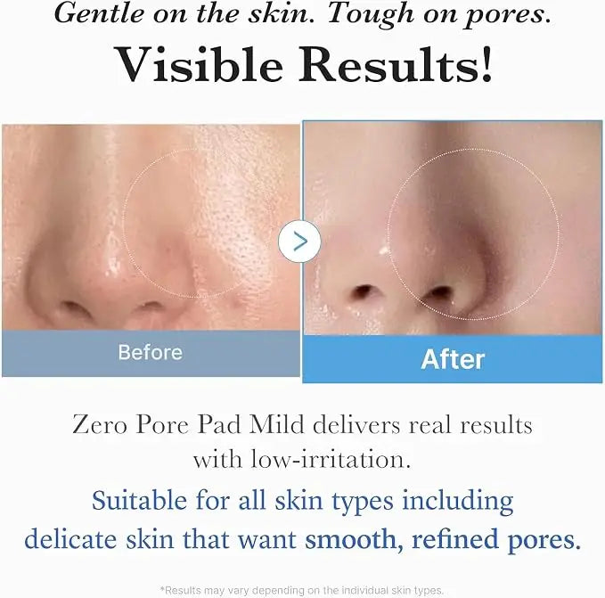 medicube Zero Pore Pad Mild 2.0 | Dischetti Esfolianti con PHA, Centella e Acido Ialuronico | Riduce Pori, Punti Neri e Sebo | Doppia Texture | Pelle Sensibile | Cosmetici Coreani | 70 pz
