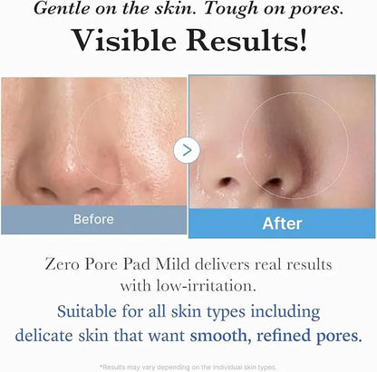 medicube Zero Pore Pad Mild 2.0 | Dischetti Esfolianti con PHA, Centella e Acido Ialuronico | Riduce Pori, Punti Neri e Sebo | Doppia Texture | Pelle Sensibile | Cosmetici Coreani | 70 pz