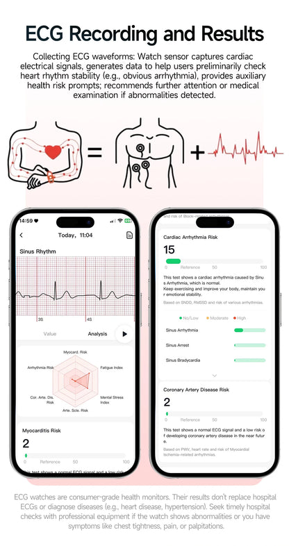 Nuovo Smartwatch per Uomo con Diagnosi ECG Accurata, Misurazione di Pressione Sanguigna, Ossigeno nel Sangue, Grasso nel Sangue, Acido Urico, Temperatura, Chiamate Bluetooth